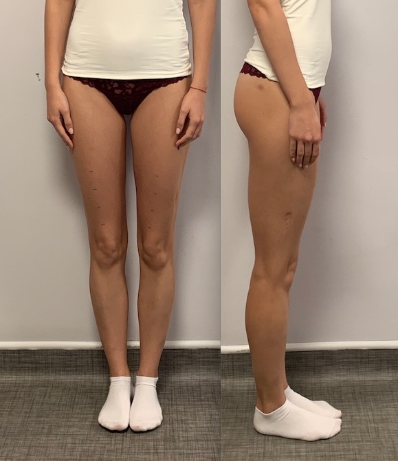 Want to be taller Want to be taller